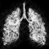 Lunge aus Rauch