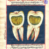 abbildung des Zahnwurms aus einem osmanischen Lehrbuch des 18. Jahrhunderts