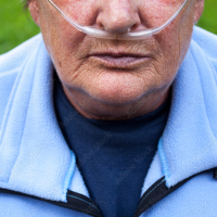 Älterer Mensch mit Nasenschlauch