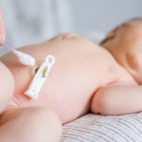 Nabelpflege bei einem Baby