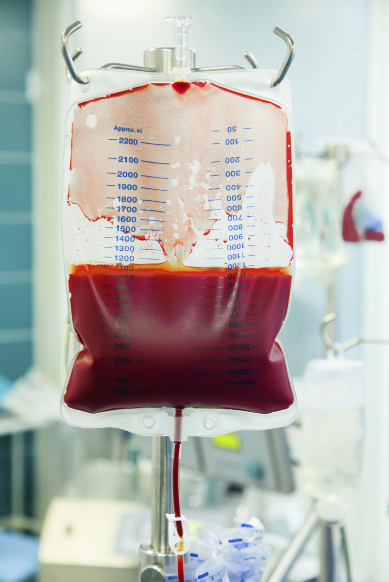 Sind niedrige Hämoglobin-Schwellenwerte für Bluttransfusionen sicher ...