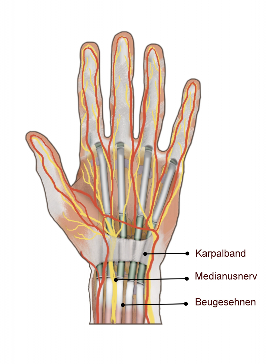 Abbildung einer Hand mit Karpaltunnel und Medianusnerv